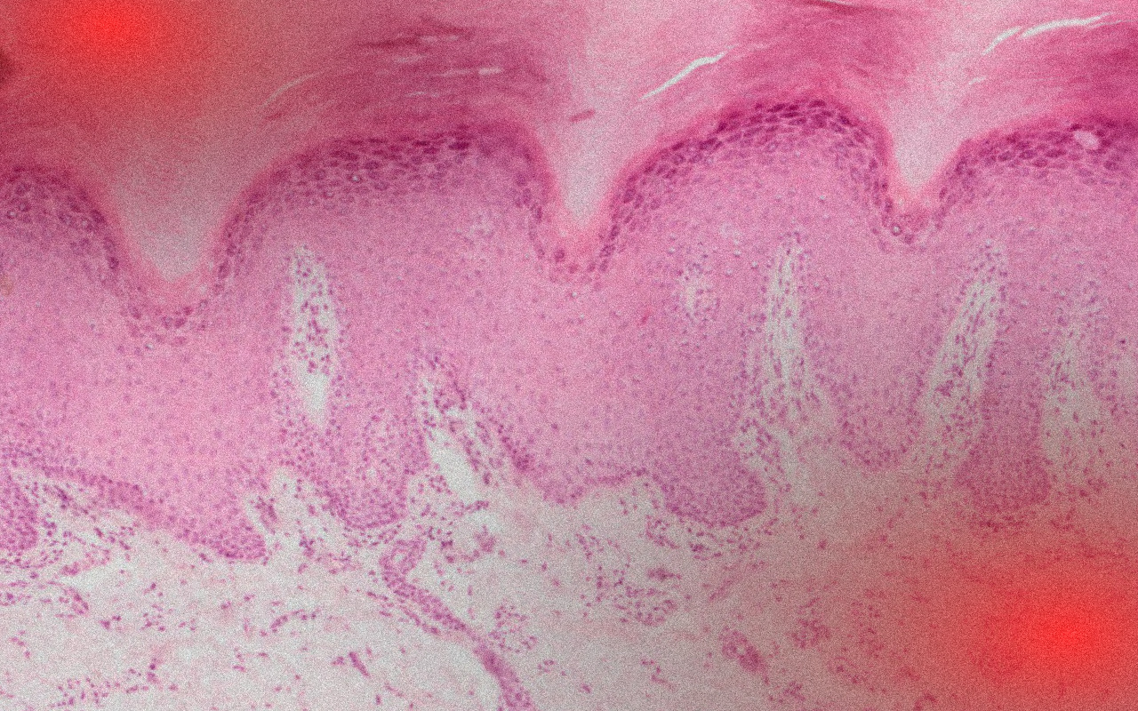 Detail tlustého typu kůže