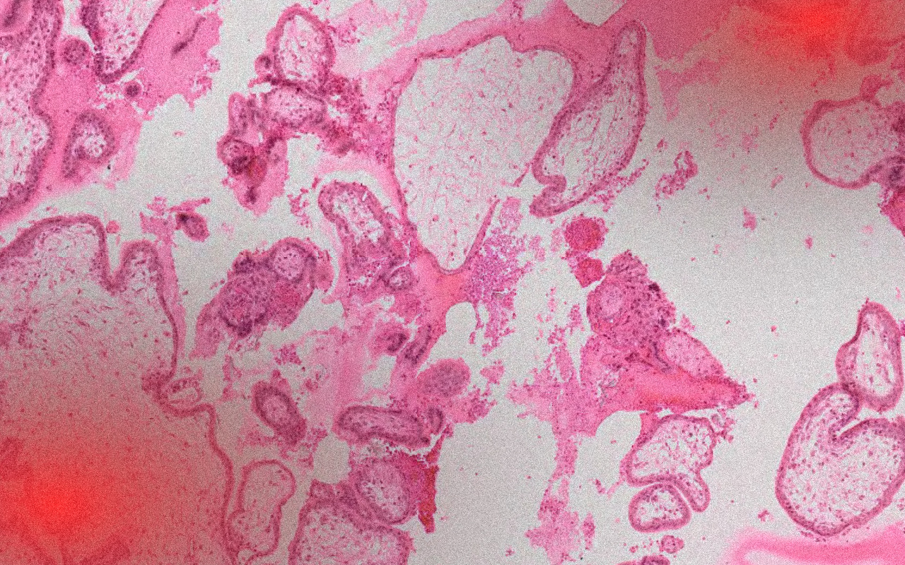 Detail choriových klků>